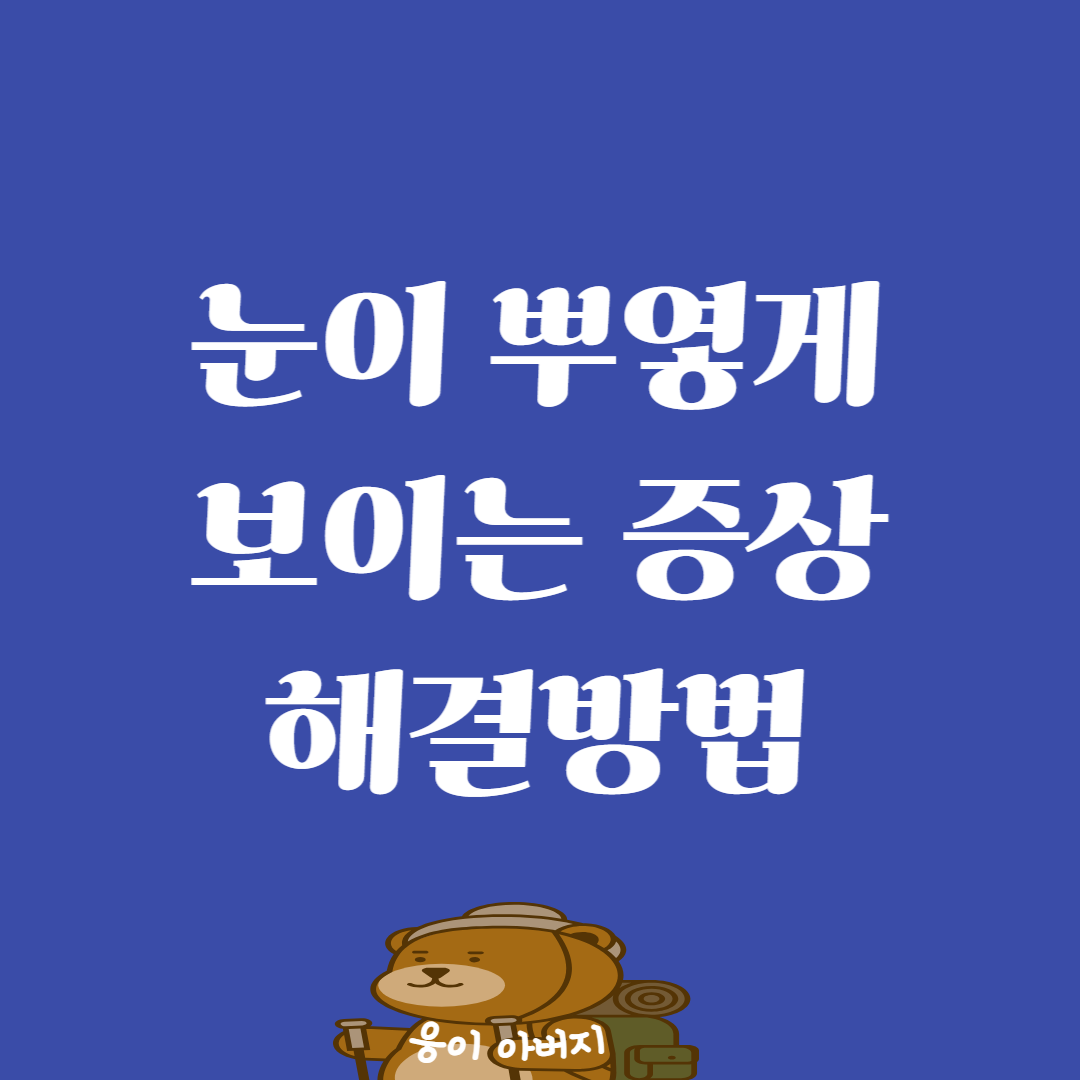 갑자기 눈이 뿌옇게보임 증상 해결방법1