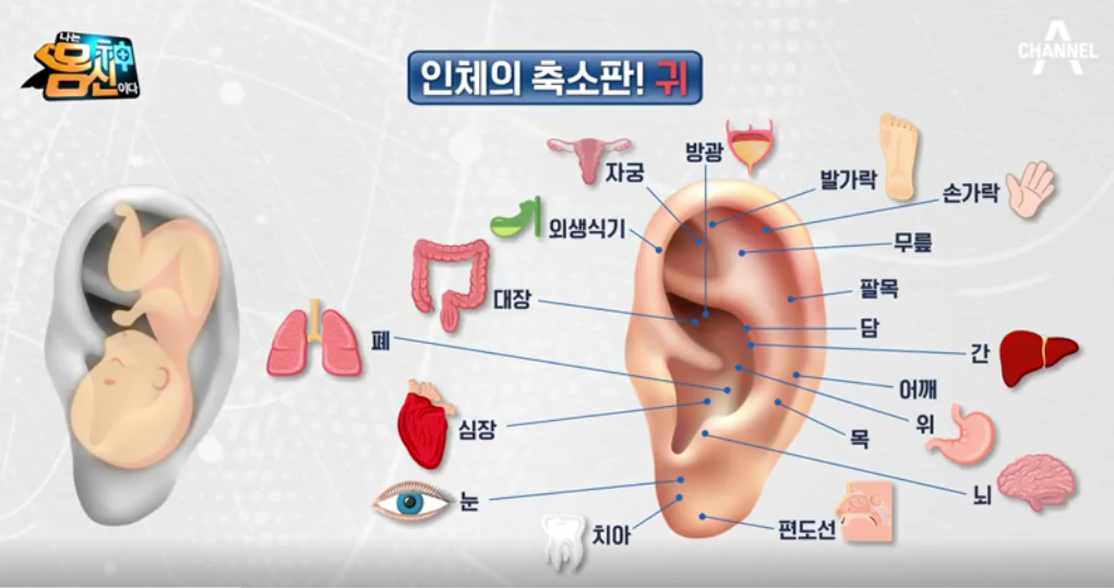  몸신 귀지압 지압점 (목/어깨, 허리, 무릎, 리프팅) + 귀 지압패치 사는곳