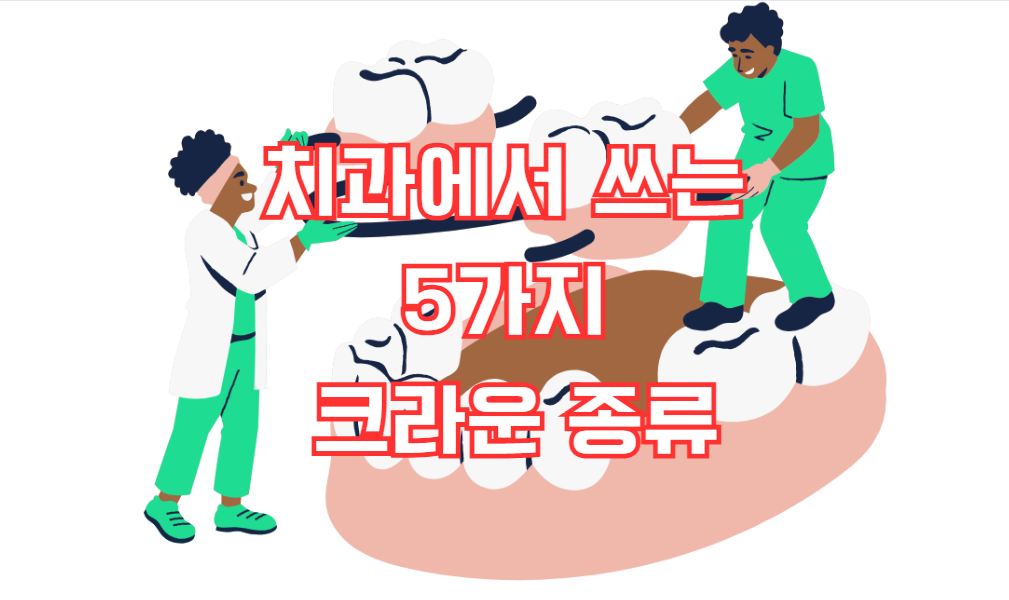 치과에서 쓰는 5가지 크라운 종류