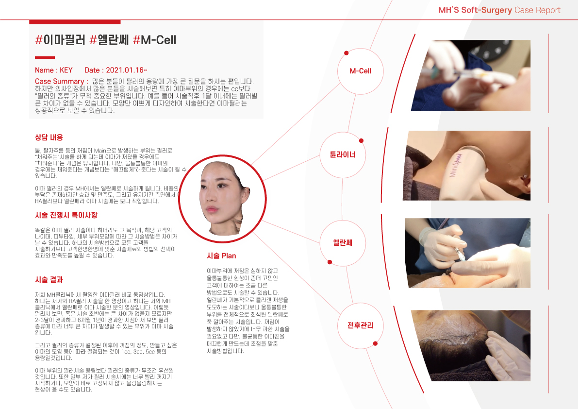 이마 엘란세 시술 만족도를 고려하여 시술합니다. 6