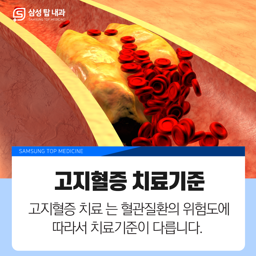 고지혈증 검사 성남 고지혈증 3