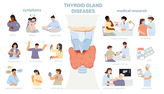 hypothyroidism