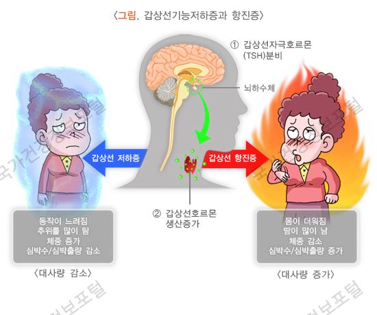  갑상선기능저하증과 항진증, 추천병원