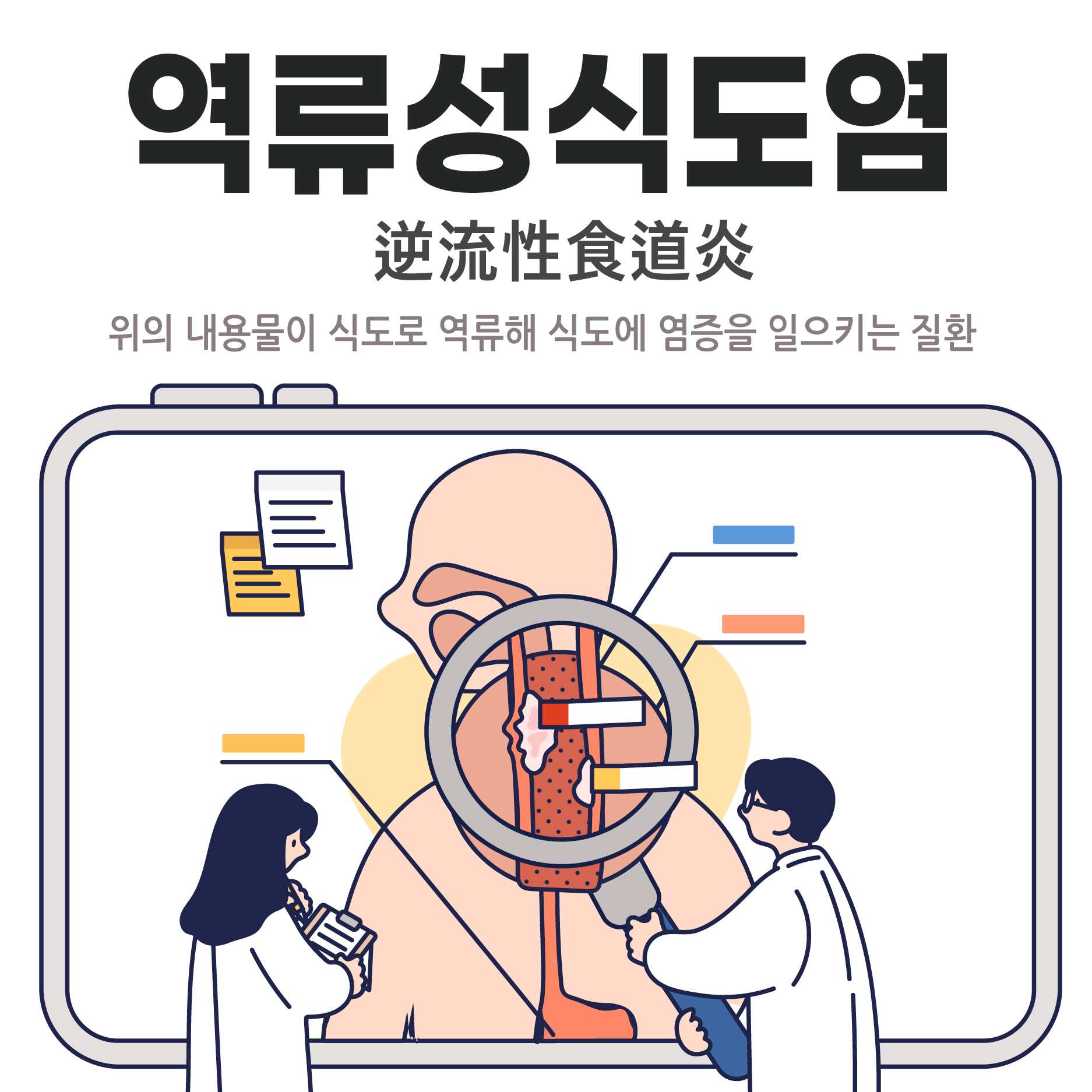  길동역한의원, 역류성 식도염 치료 받으면 효과는?