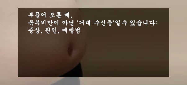  부풀어 오른 배, 복부비만이 아닌 '거대 수신증'일수 있습니다: 증상, 원인, 예방법