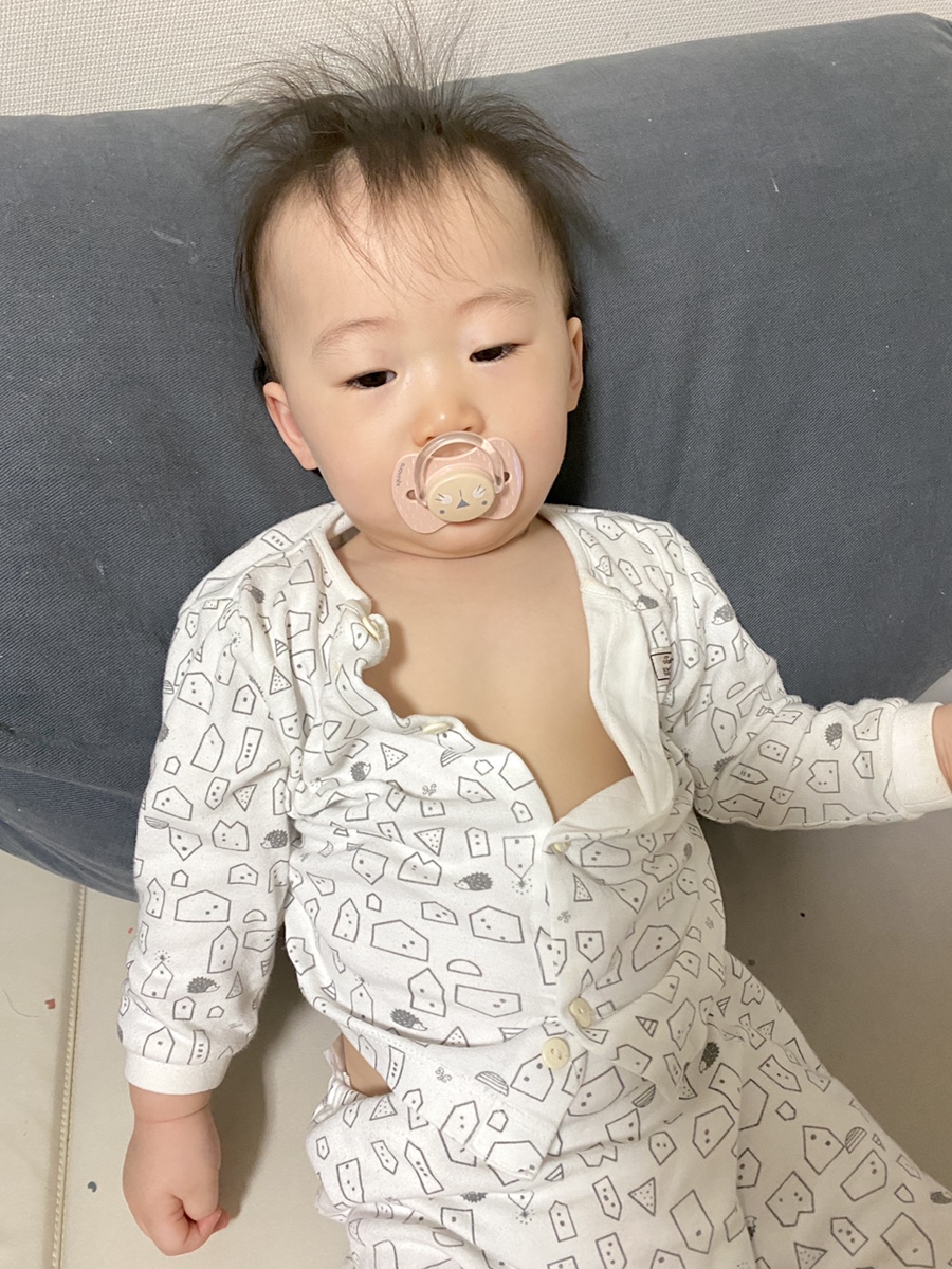 챔프 * 아기비상약 시럽, 이부펜 추천 17