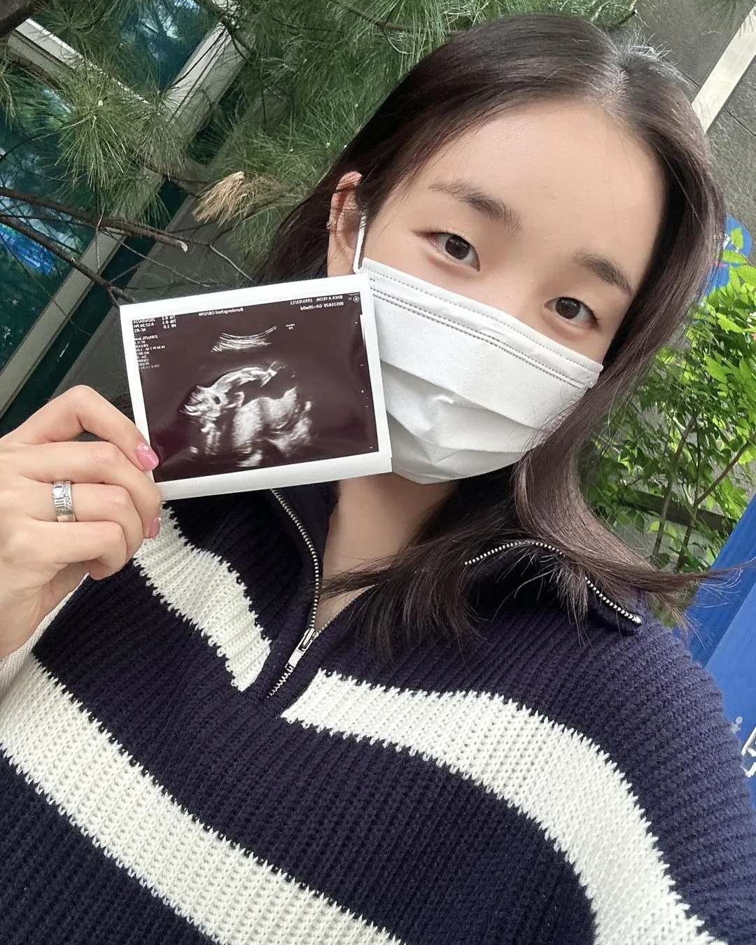 백아연_인스타그램_이미지