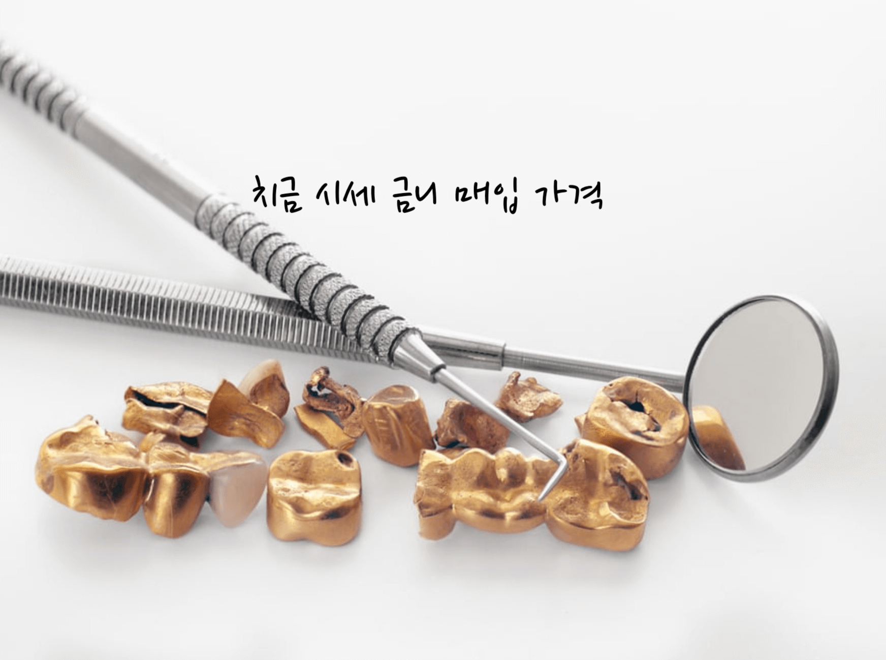 치금 시세