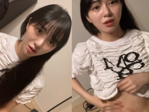  권민아, 또 자해 흔적 공개...걱정되는 팬들
