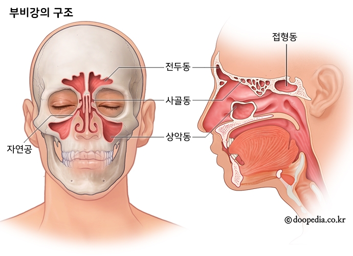 부비동, 부비강에 염증이 생겨 농이 쌓여 출이 되지 않으면 축농증이다.