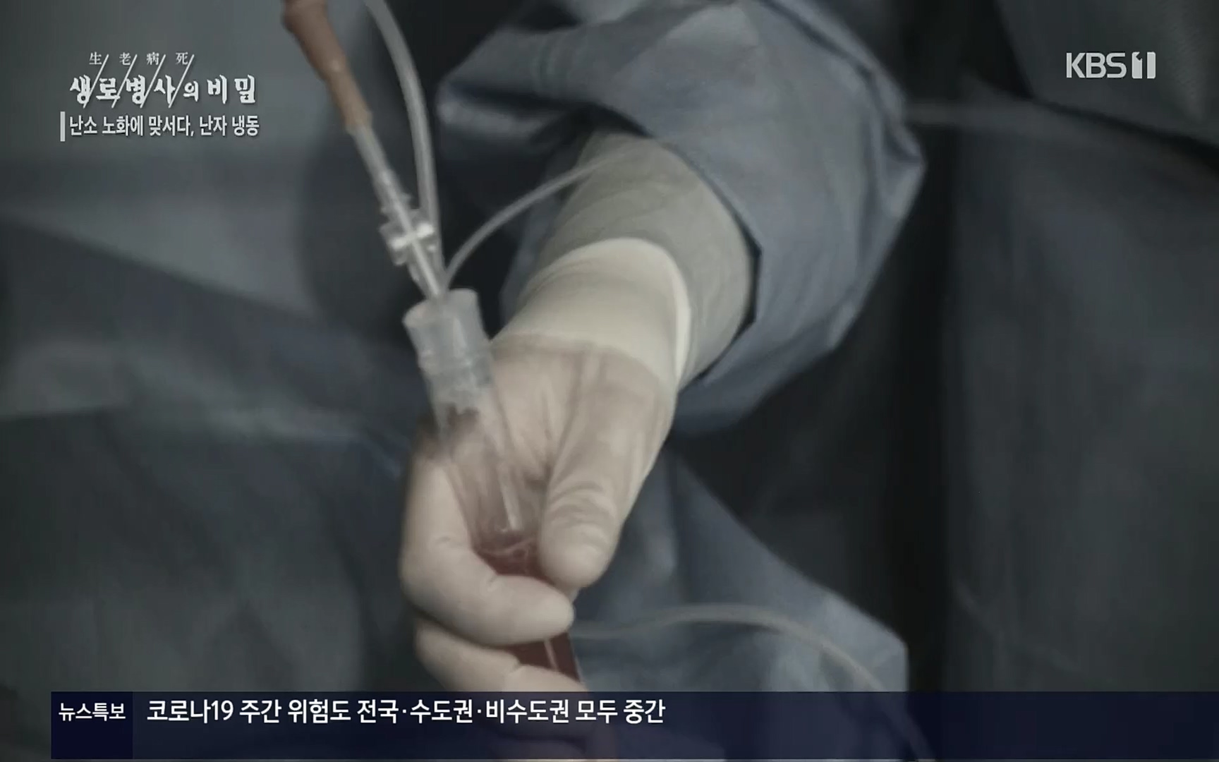 생로병사의 비밀.E836.220921p.H264-F1RST.mp4_20220925_183652.786.jpg