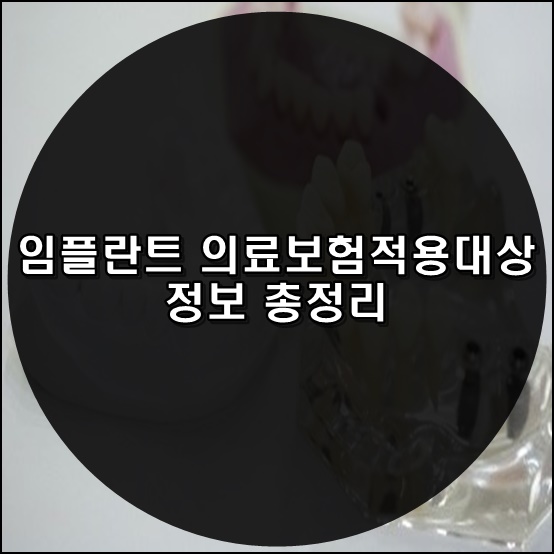  임플란트 의료보험적용대상 정보 총정리