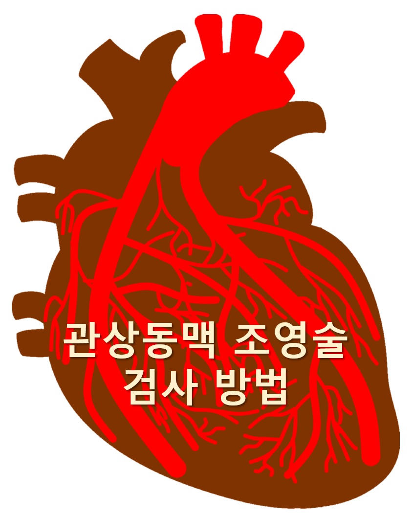  협심증과 심근경색을 진단하는 관상동맥 조영술 검사 방법
