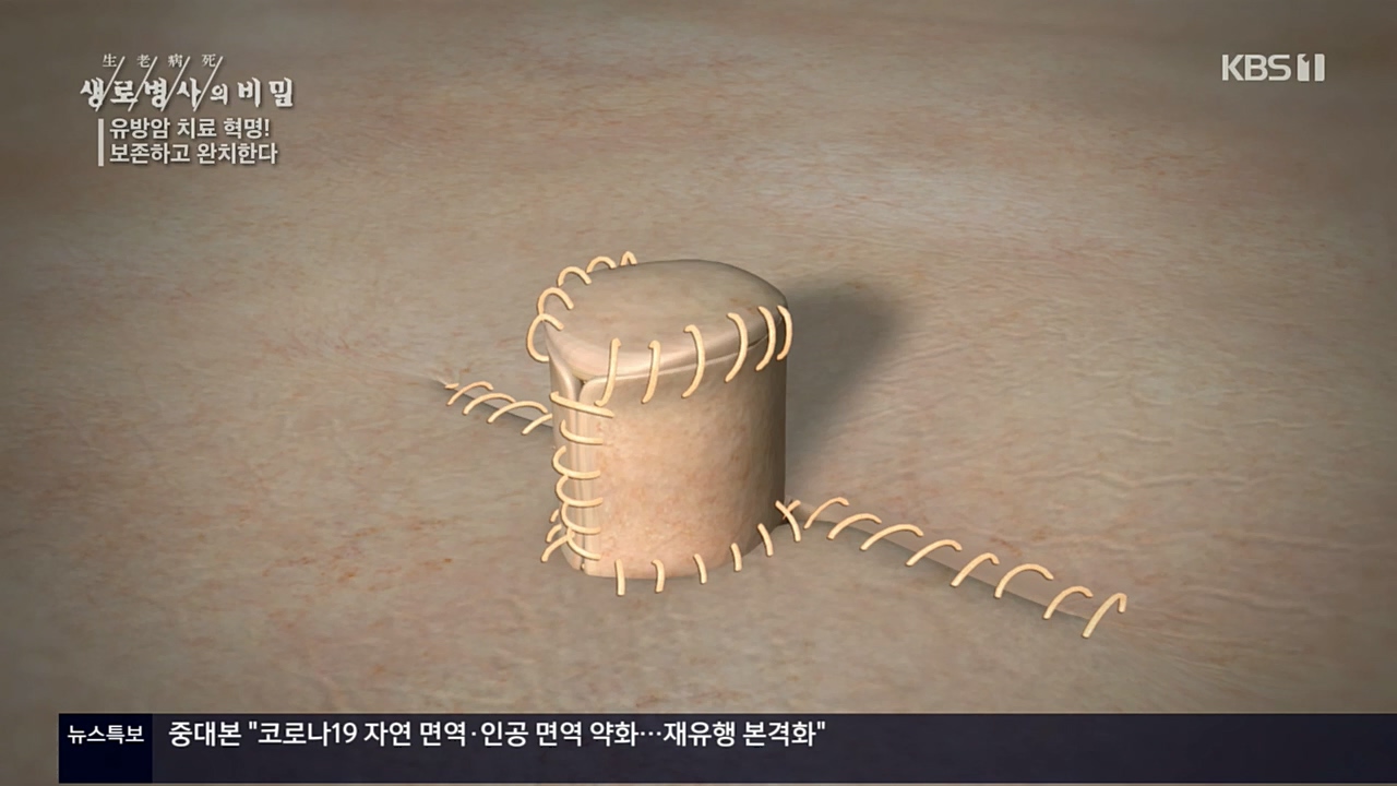 생로병사의 비밀.E845.221131p.H264-F1RST.mp4_20221201_215310.776.jpg
