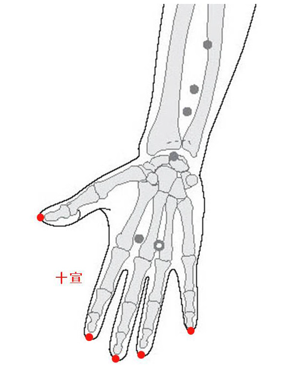경외기혈(EX) > EX-UE11 십선 (十宣) 1