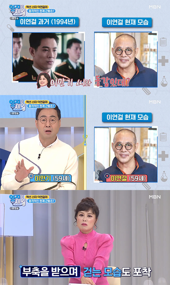  "이연걸=59세 이만기와 동갑?" 자가면역 질환으로 노화-탈모 급 진행