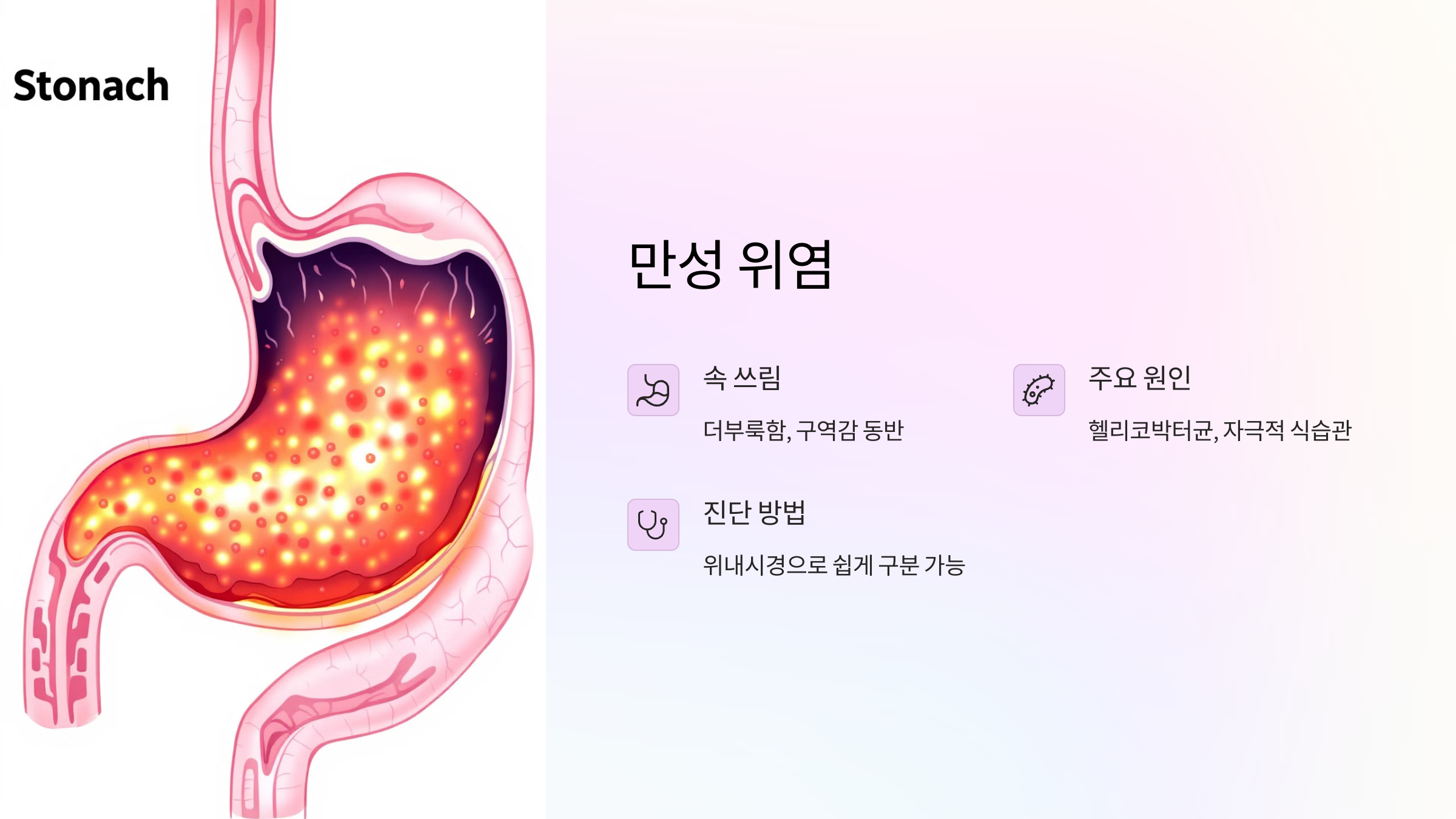 만성 위염