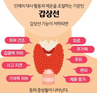 갑상샘 저하증 갑상선 기능저하증 증상 수치 치료_7