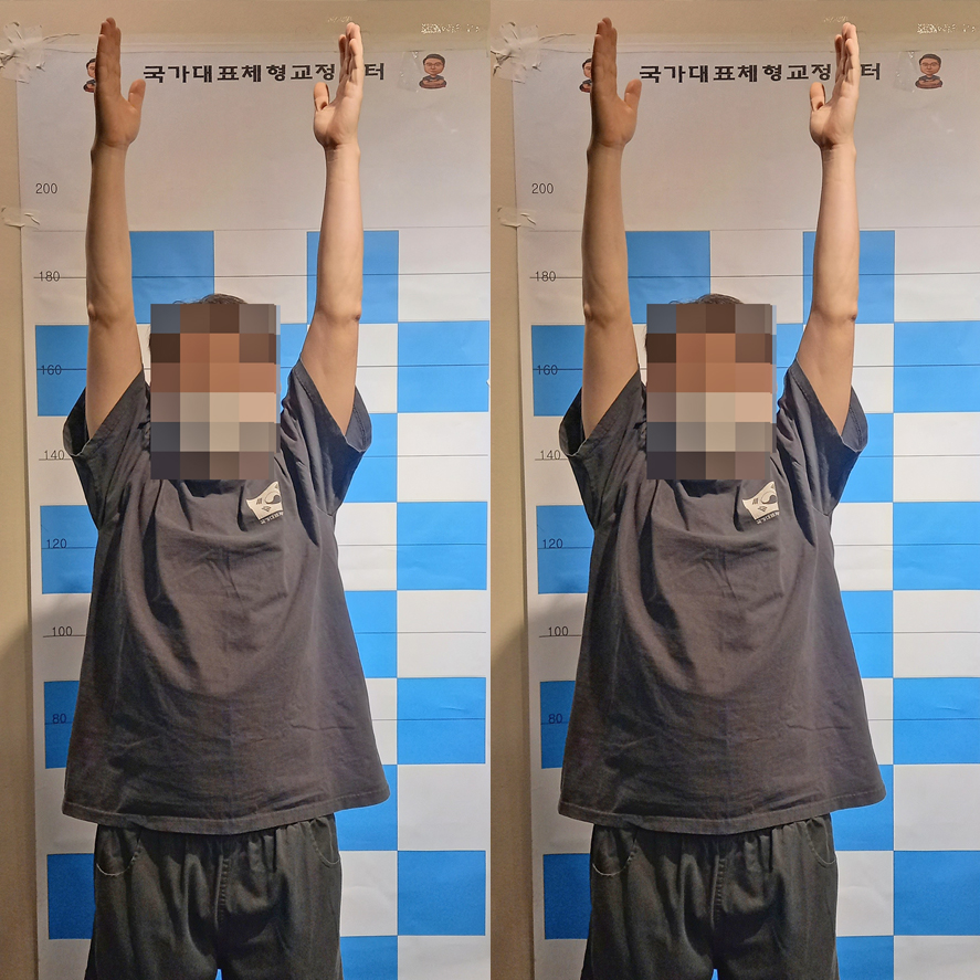 바르게 자라요.수원체형교정수원요통 7
