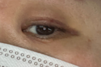 아이라인반영구 14