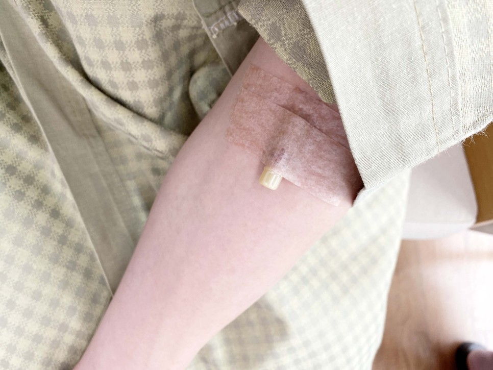 전음식 관리 (feat. 피코솔루션) 건강검진으로 받은 대장내시경 검사 22