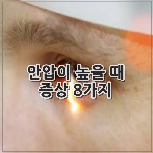 안압이 높을 때 증상 8가지