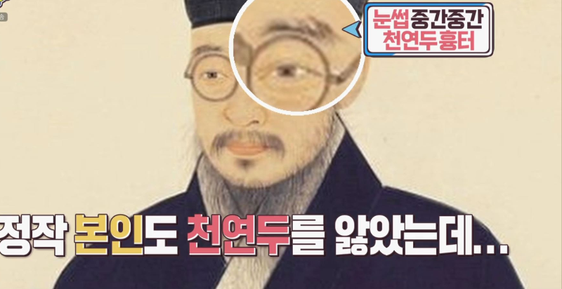 정약용 눈썹 중간의 천연두 흉터