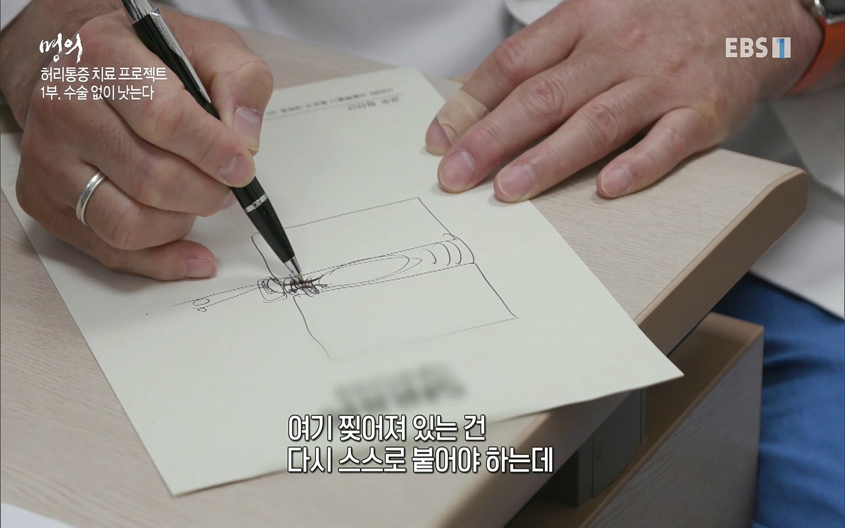 EBS 명의 헬스케어 - TV - 교육의 중심 EBS허리 통증 치료 프로젝트 1부, 수술없이 낫는다 .mp4_20220712_204226.368.jpg