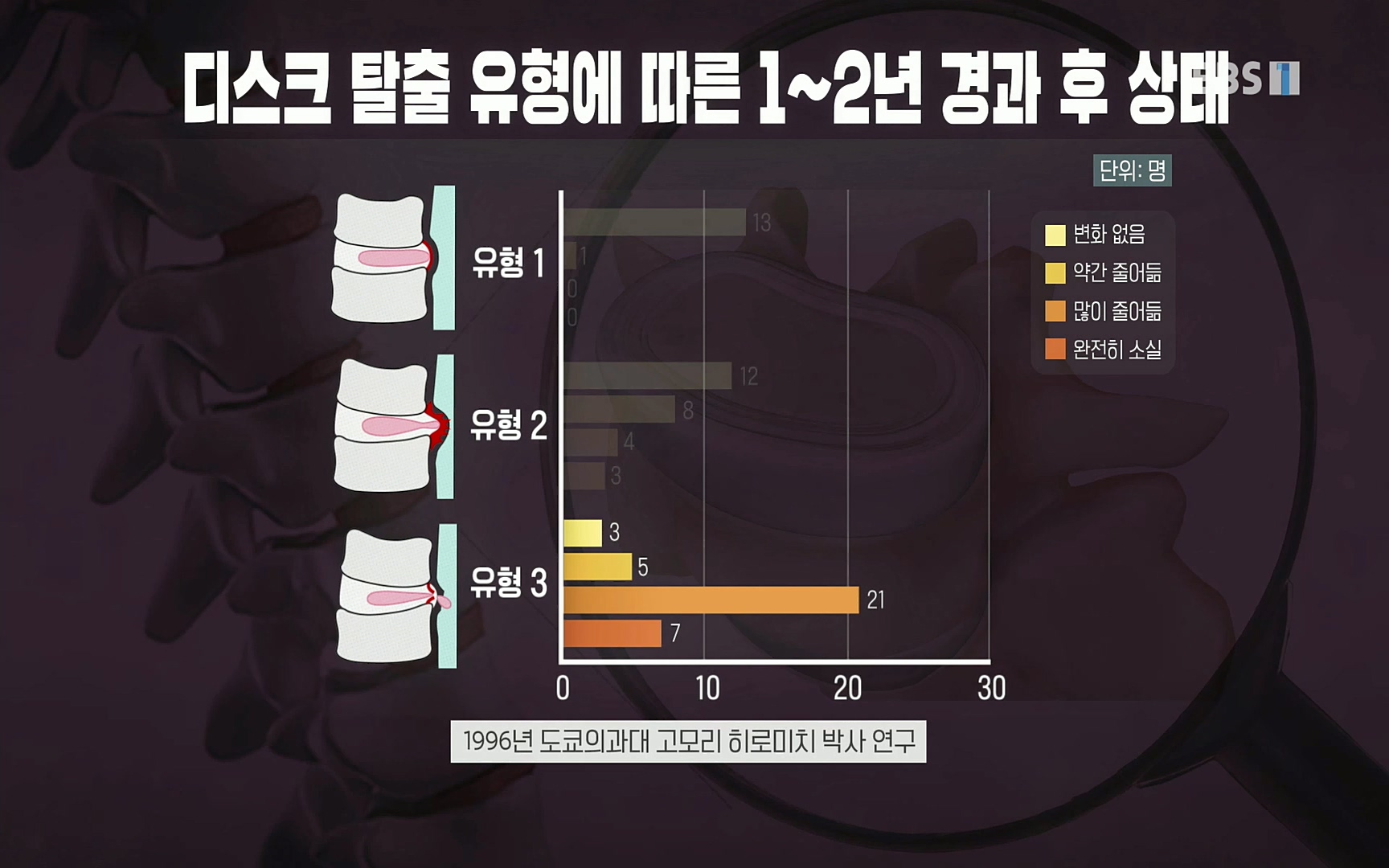 EBS 명의 헬스케어 - TV - 교육의 중심 EBS허리 통증 치료 프로젝트 1부, 수술없이 낫는다 .mp4_20220712_204228.089.jpg