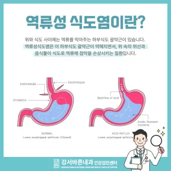역류성 식도염 원인 초기증상 예방하는 방법_4