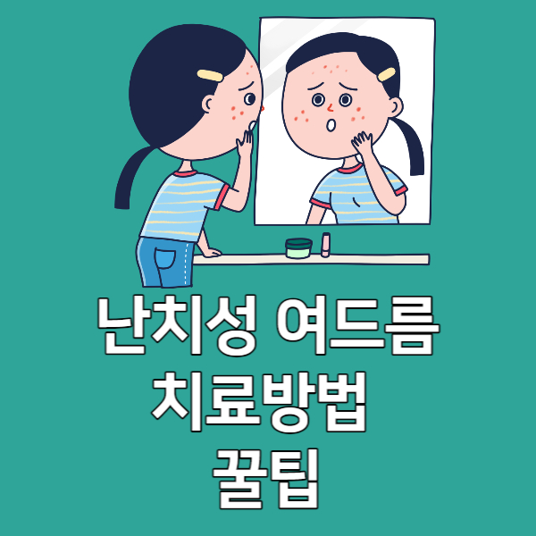 난치성여드름치료방법꿀팁