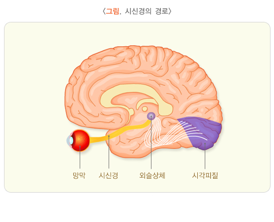  시신경염