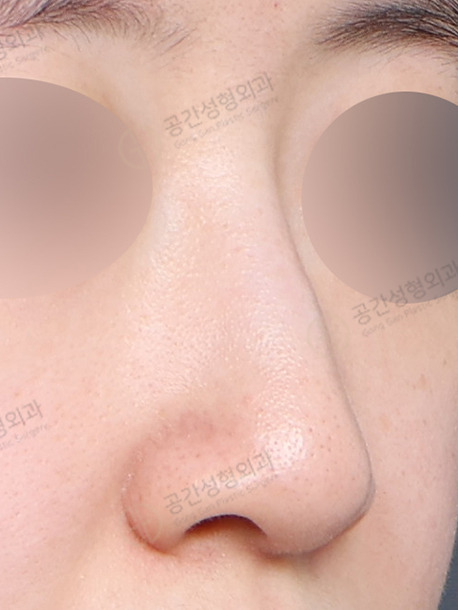 케이스코 이미지