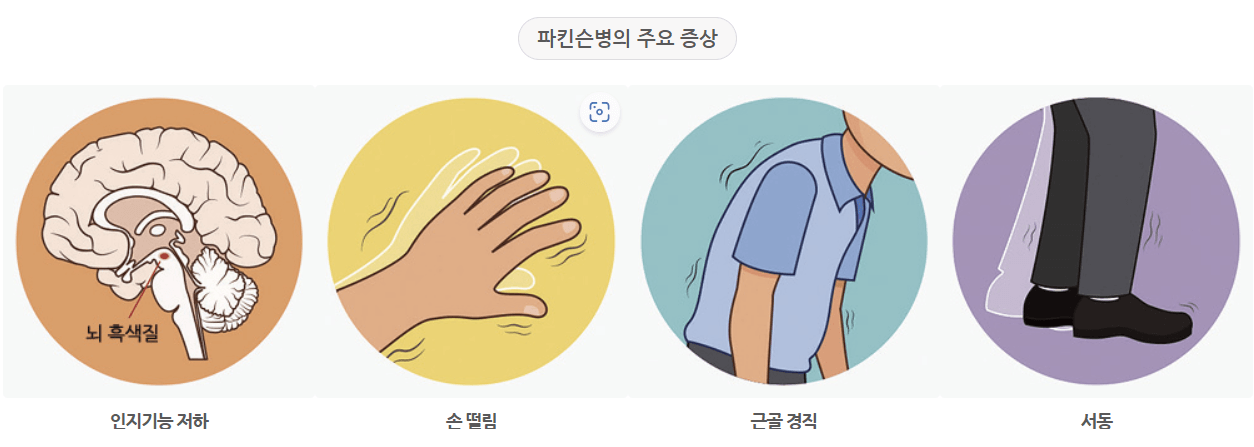 파킨슨병 주요 증상