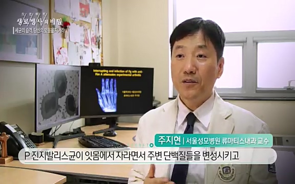 [792회] 생로병사의 비밀 - KBS[세균의 습격, 당신의 잇몸을 지켜라!] 감기보다 병원을 더 자주 찾게 만드는 질병이 있다. 바로 치주질환이다. 2020년 외래 다빈도 질병 1위를 차지한 치은염 및 치주질환 환자는 1,637_20220505_140836.832.jpg