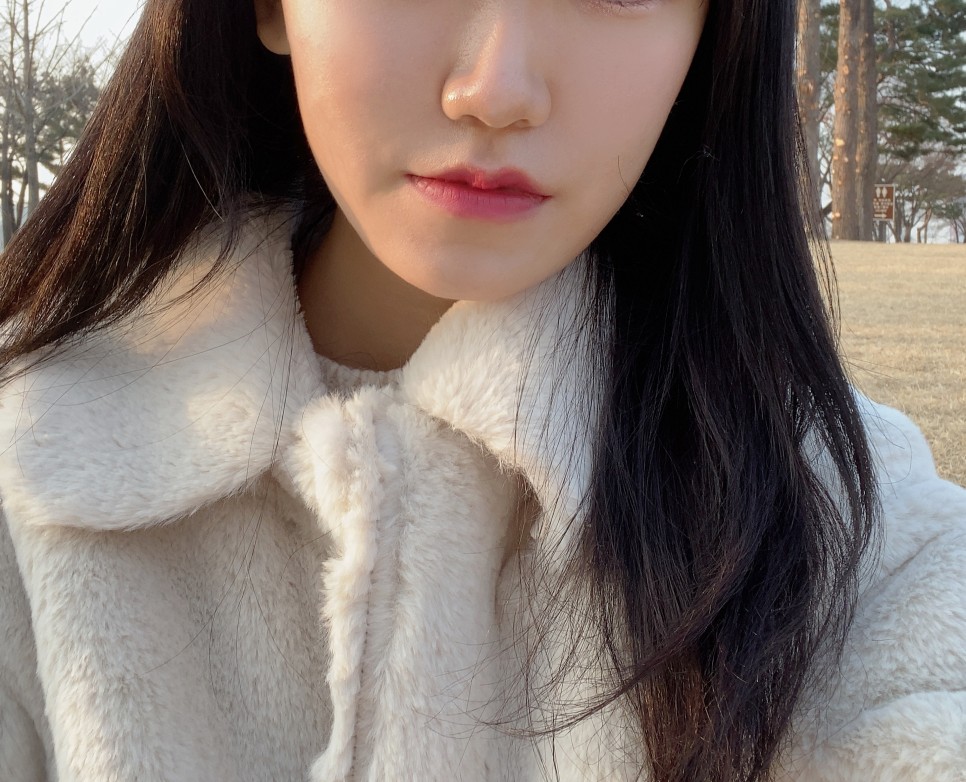 2차 코 봉오리 축소 코 조각 주사 후기교대역피부과 1개월 반 지났어 7