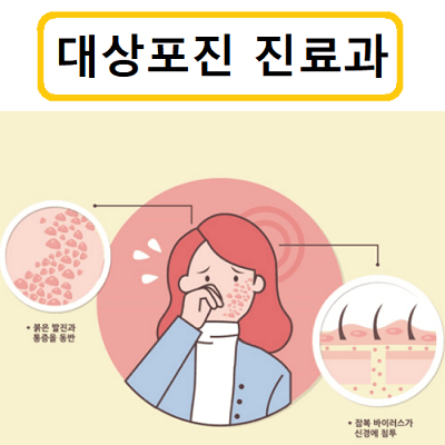 대상포진-진료과-썸네일
