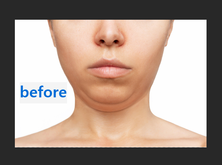 포토샵으로 이중턱 없애기 13