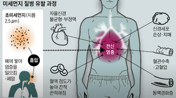 미세먼지 질병 유발 과정