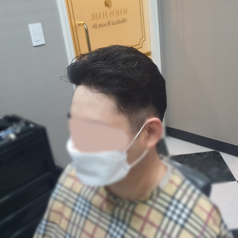 부분가발 여기 있었네 4
