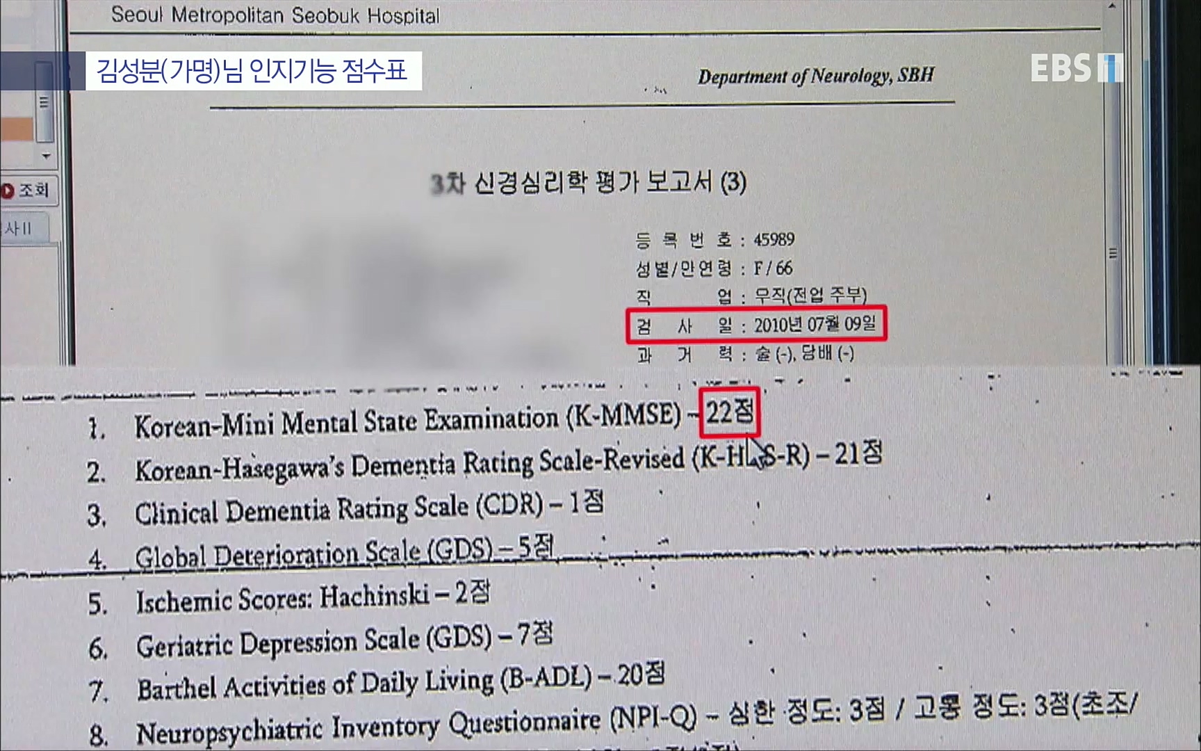 EBS 명의 헬스케어 - TV - 교육의 중심 EBS명의 15년 치매 치료의 패러다임이 바뀐다.mp4_20220808_211004.195.jpg