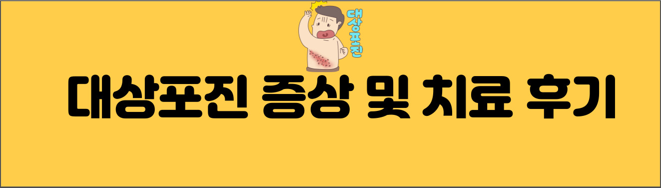 대상포진 증상 및 치료 후기