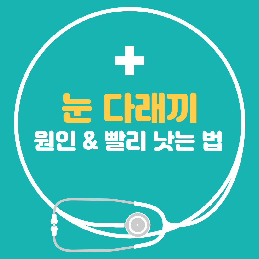  눈다래끼 원인, 빨리 낫는 법, 약, 치료, 먹으면 안되는 음식 간단정리