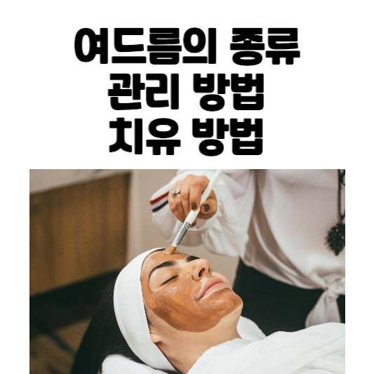 여드름의 종류&#44; 관리 방법&#44; 치유 방법