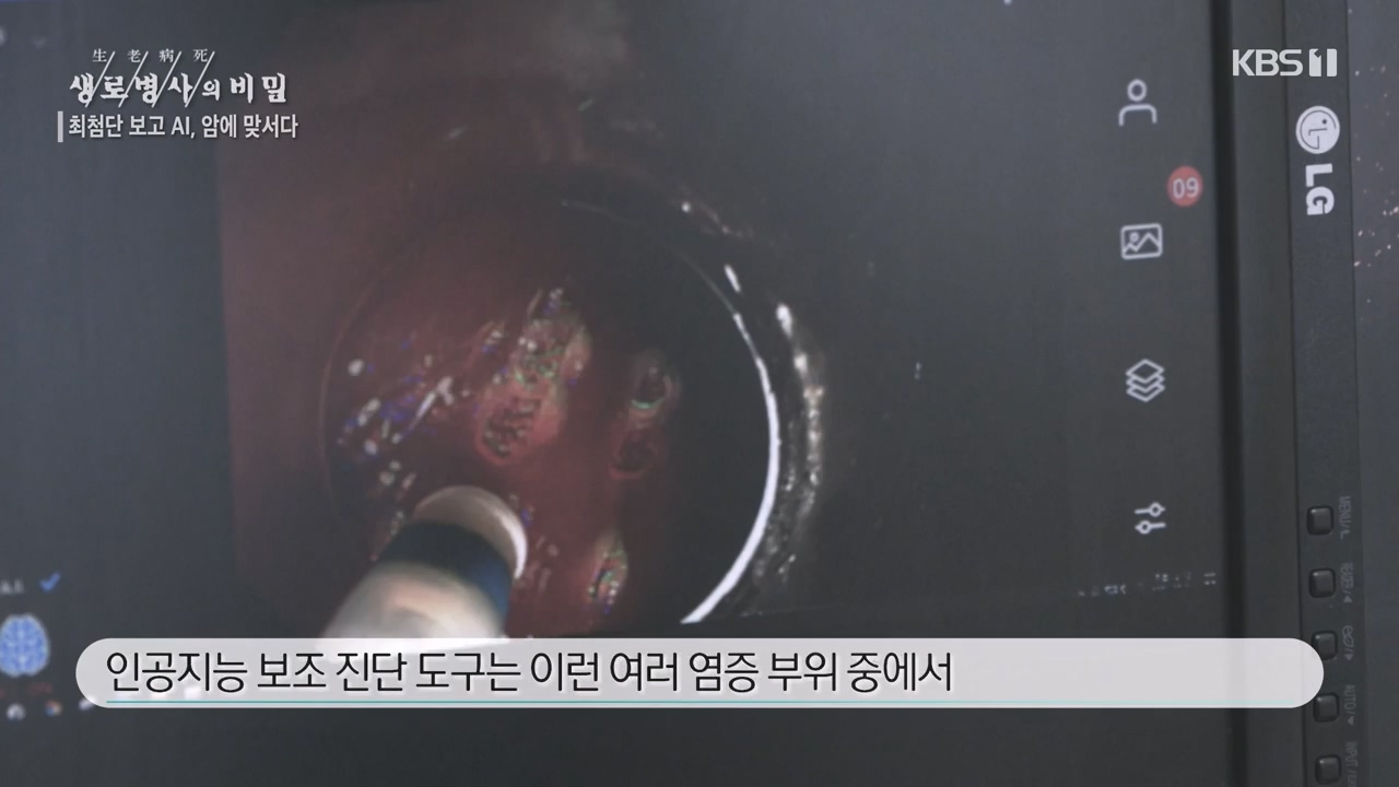 생로병사의 비밀.E881.230831p-NEXT.mp4_20230901_223249.120.jpg