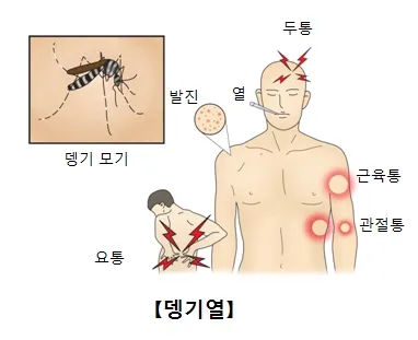 뎅기열 바이러스 증상