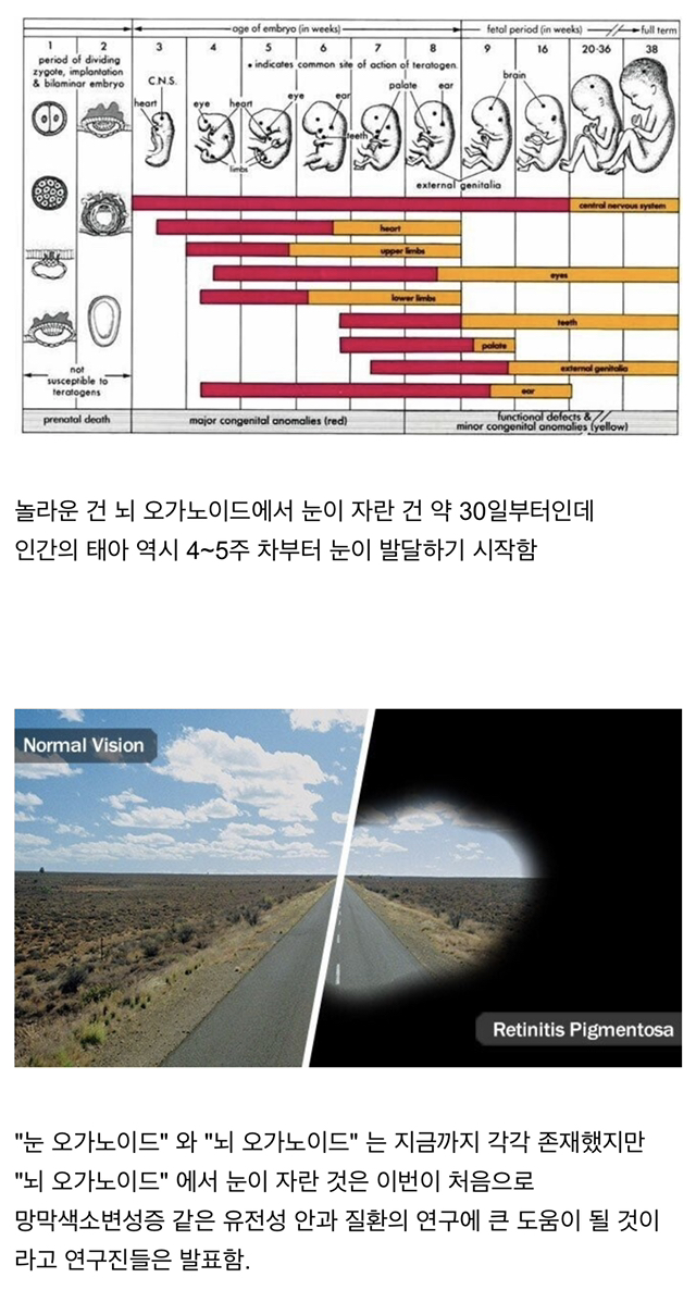인공장기에서 눈이 생긴 놀라운 사건 4