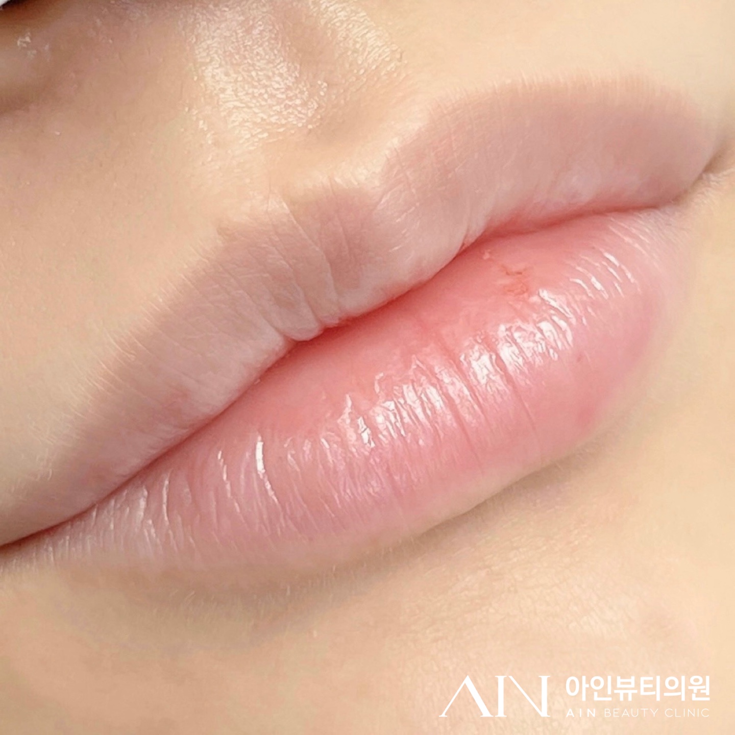  촉촉 생기 입술 반영구
