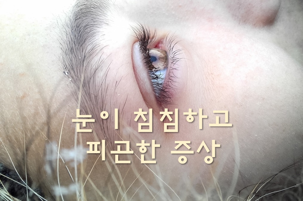  눈이 침침하고 피곤한 증상과 어지러움의 원인