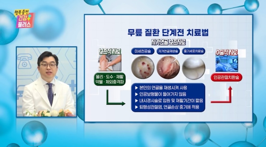  무릎 인공관절수술 전치환술, 부분치환술에 대해